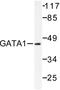 GATA Binding Protein 1 antibody, AP06135PU-N, Origene, Western Blot image 