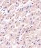 2ABA antibody, A04159, Boster Biological Technology, Immunohistochemistry paraffin image 