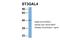 ST3 Beta-Galactoside Alpha-2,3-Sialyltransferase 4 antibody, NBP1-62481, Novus Biologicals, Western Blot image 