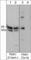 3-Phosphoinositide Dependent Protein Kinase 1 antibody, PP1431, ECM Biosciences, Western Blot image 