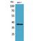 Thrombopoietin antibody, LS-C387178, Lifespan Biosciences, Western Blot image 