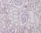 Phosphatidylinositol 3-Kinase Catalytic Subunit Type 3 antibody, M02356, Boster Biological Technology, Immunohistochemistry paraffin image 