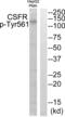 Colony Stimulating Factor 1 Receptor antibody, abx012479, Abbexa, Western Blot image 