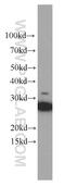 Synaptosome Associated Protein 25 antibody, 60159-1-Ig, Proteintech Group, Western Blot image 