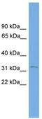 Serine Protease 21 antibody, TA335395, Origene, Western Blot image 