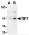 Interferon Regulatory Factor 7 antibody, 3943, ProSci, Western Blot image 