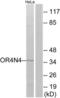 Olfactory Receptor Family 4 Subfamily N Member 4 antibody, LS-C199353, Lifespan Biosciences, Western Blot image 