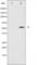 Peroxisome Proliferator Activated Receptor Gamma antibody, abx011789, Abbexa, Western Blot image 