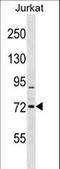 Rho Related BTB Domain Containing 1 antibody, LS-C162592, Lifespan Biosciences, Western Blot image 