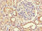 Ribulose-5-Phosphate-3-Epimerase antibody, LS-C397755, Lifespan Biosciences, Immunohistochemistry paraffin image 