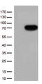 Colony Stimulating Factor 2 Receptor Alpha Subunit antibody, CF812521, Origene, Western Blot image 