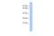 Outer Dense Fiber Of Sperm Tails 4 antibody, A14705, Boster Biological Technology, Western Blot image 