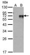 Nuclear Receptor Subfamily 4 Group A Member 1 antibody, GTX100797, GeneTex, Western Blot image 