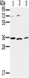 Interleukin 22 Receptor Subunit Alpha 2 antibody, TA350086, Origene, Western Blot image 
