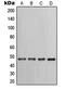 Keratin 17 antibody, MBS821848, MyBioSource, Western Blot image 