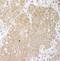 Cbl Proto-Oncogene B antibody, NBP1-49919, Novus Biologicals, Immunohistochemistry paraffin image 