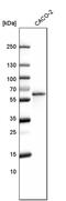 Lipolysis Stimulated Lipoprotein Receptor antibody, PA5-52412, Invitrogen Antibodies, Western Blot image 