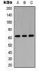 Gamma-Glutamyltransferase 5 antibody, LS-C354373, Lifespan Biosciences, Western Blot image 