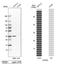 Cyclin D2 antibody, NBP2-14460, Novus Biologicals, Western Blot image 