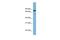 Neurochondrin antibody, PA5-44254, Invitrogen Antibodies, Western Blot image 