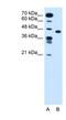 Solute Carrier Family 35 Member C1 antibody, NBP1-59386, Novus Biologicals, Western Blot image 