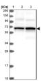 Trichoplein Keratin Filament Binding antibody, NBP1-89572, Novus Biologicals, Western Blot image 