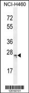 BMERB Domain Containing 1 antibody, 55-443, ProSci, Western Blot image 