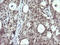 Mitogen-Activated Protein Kinase Kinase 1 antibody, LS-C174635, Lifespan Biosciences, Immunohistochemistry paraffin image 