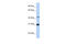 Nucleoporin 35 antibody, 26-659, ProSci, Enzyme Linked Immunosorbent Assay image 