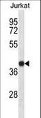 SET Nuclear Proto-Oncogene antibody, LS-B14766, Lifespan Biosciences, Western Blot image 