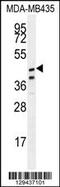 Sterile Alpha Motif Domain Containing 7 antibody, 55-831, ProSci, Western Blot image 