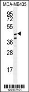 Sterile alpha motif domain-containing protein 7 antibody, 55-831, ProSci, Western Blot image 