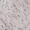 Lysosomal Associated Membrane Protein 1 antibody, AMAb91168, Atlas Antibodies, Immunohistochemistry frozen image 