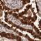Pleckstrin Homology Domain Containing A1 antibody, PA5-51675, Invitrogen Antibodies, Immunohistochemistry paraffin image 