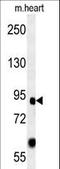 Forkhead Box P2 antibody, LS-C166242, Lifespan Biosciences, Western Blot image 