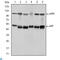 Nuclear Factor Kappa B Subunit 1 antibody, LS-C814033, Lifespan Biosciences, Enzyme Linked Immunosorbent Assay image 
