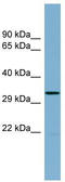 TRNA-Histidine Guanylyltransferase 1 Like antibody, TA342533, Origene, Western Blot image 