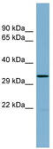 TRNA-Histidine Guanylyltransferase 1 Like antibody, TA342533, Origene, Western Blot image 