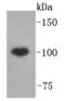 ATP-binding cassette sub-family F member 1 antibody, A05358-1, Boster Biological Technology, Western Blot image 