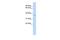 Sideroflexin 3 antibody, GTX45948, GeneTex, Western Blot image 