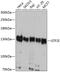 SPIN antibody, GTX64832, GeneTex, Western Blot image 