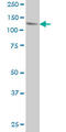 Ubiquitin Specific Peptidase 48 antibody, LS-C105188, Lifespan Biosciences, Western Blot image 