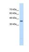 Beta-Ureidopropionase 1 antibody, NBP1-54393, Novus Biologicals, Western Blot image 