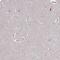 Centromere Protein T antibody, PA5-63512, Invitrogen Antibodies, Immunohistochemistry frozen image 