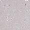 Centromere Protein T antibody, PA5-63512, Invitrogen Antibodies, Immunohistochemistry frozen image 