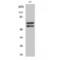 LYN Proto-Oncogene, Src Family Tyrosine Kinase antibody, LS-C381202, Lifespan Biosciences, Western Blot image 