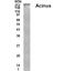 Apoptotic Chromatin Condensation Inducer 1 antibody, GTX70369, GeneTex, Western Blot image 