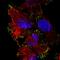 N-Acylsphingosine Amidohydrolase 2 antibody, HPA061171, Atlas Antibodies, Immunofluorescence image 