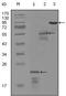 Erb-B2 Receptor Tyrosine Kinase 3 antibody, MA5-15438, Invitrogen Antibodies, Western Blot image 