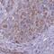 Transmembrane Protein 86B antibody, NBP2-31684, Novus Biologicals, Immunohistochemistry frozen image 